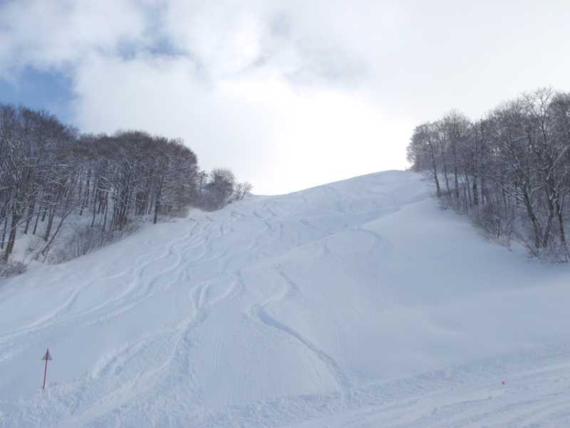 松之山温泉スキー場の画像